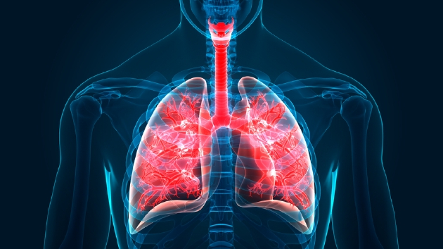 陽康后憋氣不足40秒就是肺有問題？